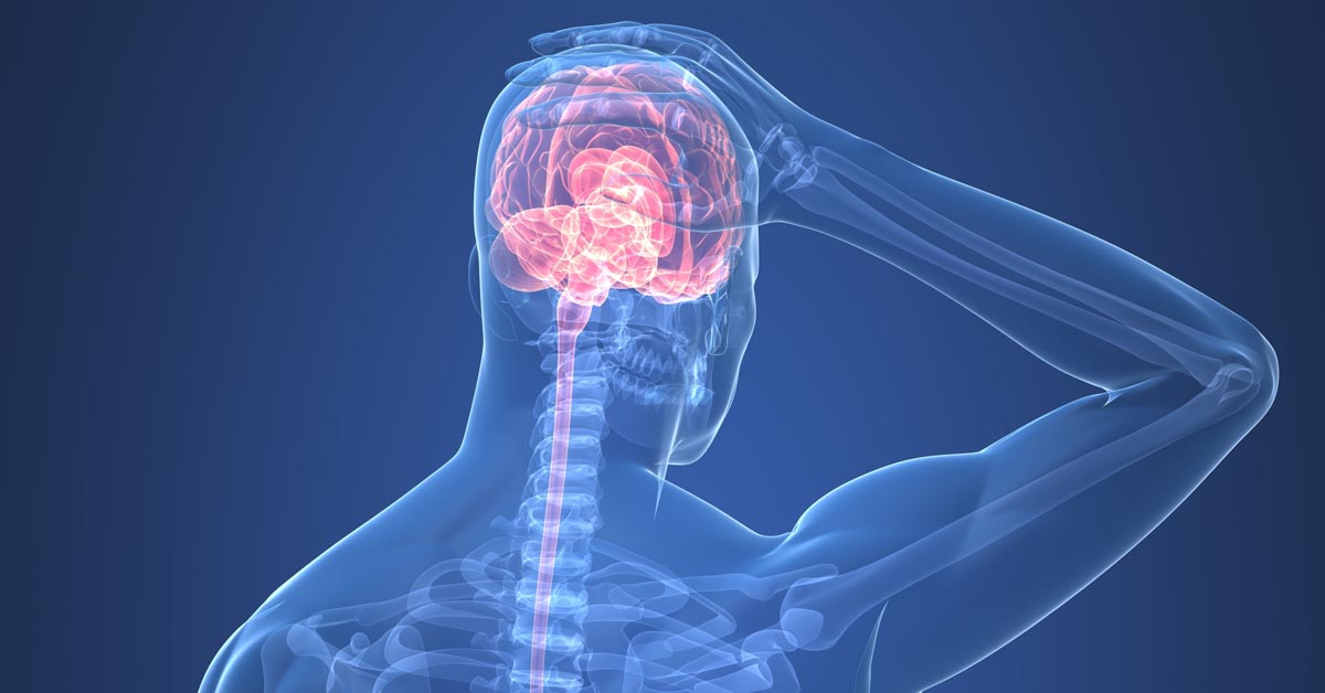 Featured image for Rutland Cervicogenic Headache Treatment